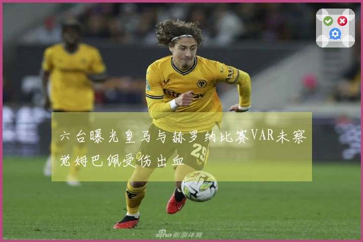 六台曝光皇马与赫罗纳比赛VAR未察觉姆巴佩受伤出血